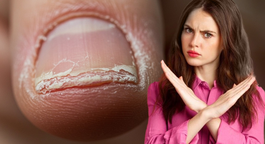 ¿Qué le sucede a tus uñas si no usas una preparación adecuada antes del gel?