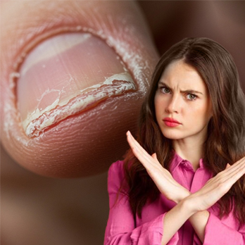 ¿Qué le sucede a tus uñas si no usas una preparación adecuada antes del gel?